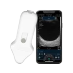 B-Scan Ultrasound Wireless System C10UE for posterior segment imaging