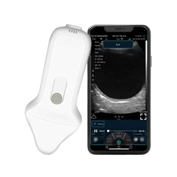 B-Scan Ultrasound Wireless System C10UE for posterior segment imaging