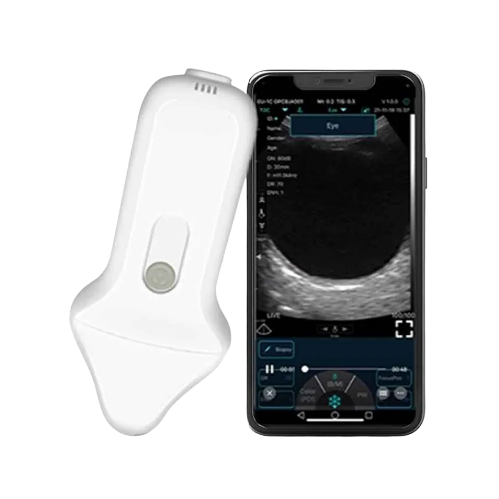 B-Scan Ultrasound Wireless System C10UE for posterior segment imaging