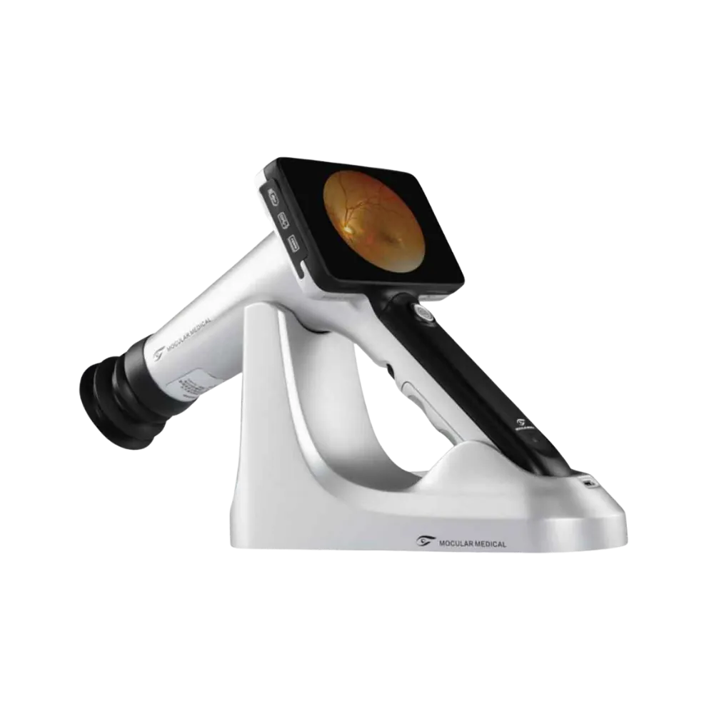 Portable Fundus Camera CFC-X enabling posterior eye imaging and diagnosis